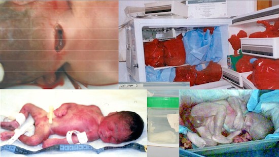 sumario-abortos-gosnell