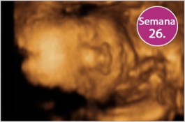 26b-ecografia-4d